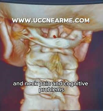 Cbct imaging locating the structural cause of migraine and vertigo | Sarasota and Tampa