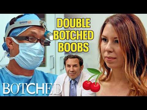 Botched By Birth AND Boob Job: Desiree's Breasts Are Screwed Up (Before & After) | Botched | E!
