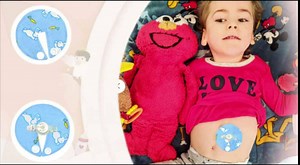 7 Pack G Tube Pads Button Feeding Tube Cover for G-Tube or J Tube Reusable and Soft