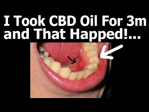 CBD Oil Side Effects (I Took CBD And That Happened!)