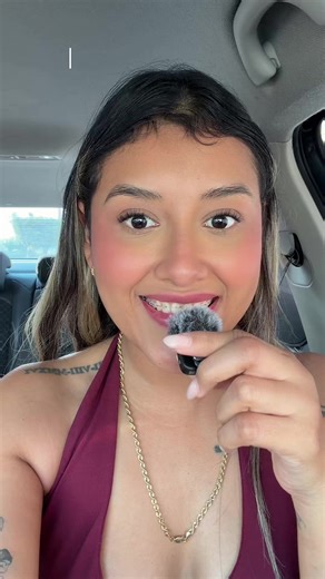 Resultados del Botox en Sonrisa Gingival: Día 1