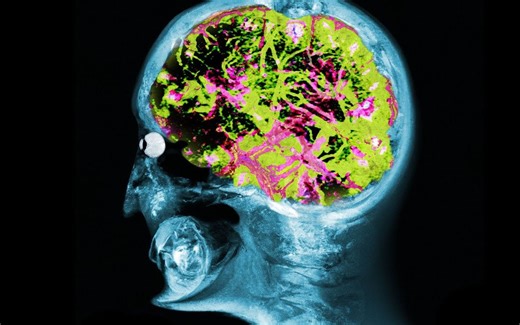 一个男性干吃了35000毫克的咖啡因，这是他的器官发生的变化