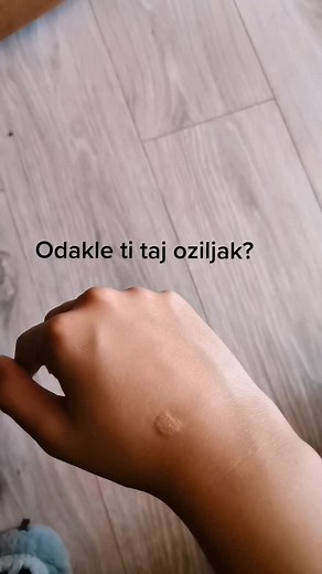 Exploring Skin Bumps and Their Causes