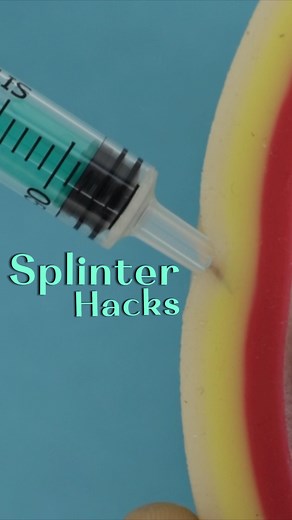 Vetventures on Instagram: "Splinter Removal Hacks Follow the Vetventures! #splinter #survival #hacks #vetsofinstsgram #veterinariansofinstagram #doctorsofinstagram #surgeonsofinstagram #medicine #surgery #survivalhack #lifehack"