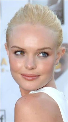 Born With 2 Eye Colors?! 👁️ The Science Behind Heterochromia #hetrochromia #contactlenses #eyes #yt