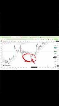 What you need to know about candlestick patterns | Charter's Fx #trading #currencytrading #forex