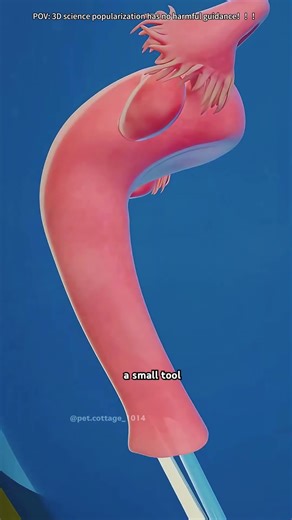 HPV Testing Explained (3D Animation)#HPVtesting #HPV #womenshealth #cervicalhealth