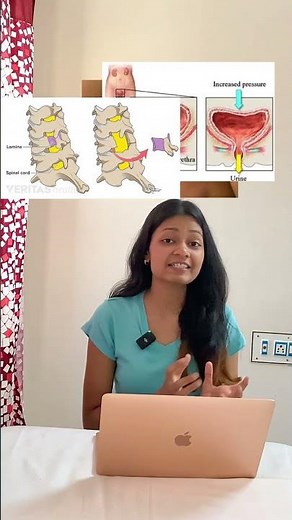 SURGERY NOTES!!! #shortsvideo #notes #physiotherapy