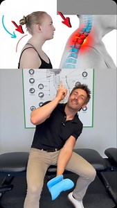 Neck hump and posture corrector. #neckhump #posture | James White - Online Coach