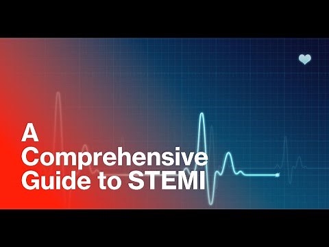 ST-Elevation Myocardial Infarction (STEMI): A Comprehensive Guide to Understanding and Recognition.