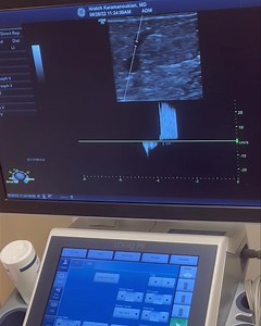 venous reflux study @veintreatmentcenter www.VeinsVeinsVeins.com #venousinsufficiency | Vein Treatment Center