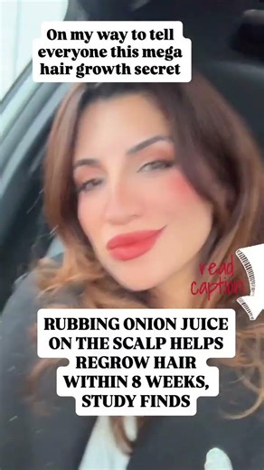 I’m not saying God put onions on this planet just for your bald spots… …but there is an actual