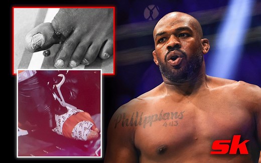 When did Jon Jones break his toe inside the octagon? Find out why 'Bones' had his foot taped ahead of UFC 285