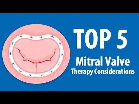Mitral Valve Awareness: Top 5 Considerations for Mitral Valve Surgery