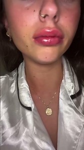 Insane results with our EXTREME lip plumper 🔥👄