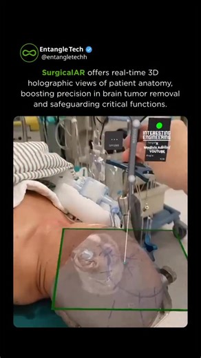 “EntangleTech” 🤖 on Instagram: "SurgicalAR offers real-time 3D holographic views of patient anatomy, boosting precision in brain tumor removal and safeguarding critical functions"