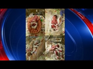 Georgia couple gives birth to quadruplets