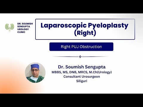 Laparoscopic Right Pyeloplasty I By Dr. Soumish Sengupta, M.Ch (Urology), Siliguri