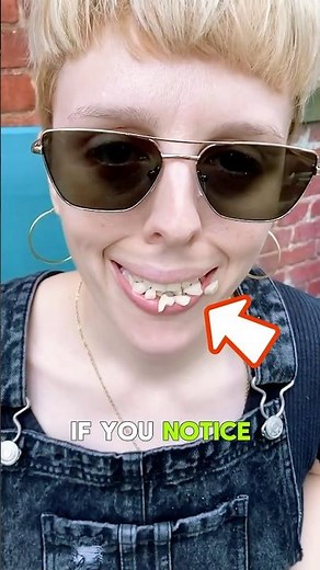 Why Are Your Teeth Suddenly Falling Out? Don’t Ignore This Warning!