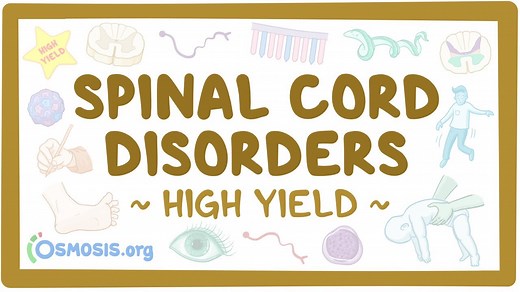 Spinal cord disorders: Pathology review: Video, Causes, & Meaning | Osmosis