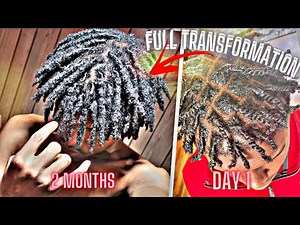 1 YEAR LOC JOURNEY |Full Transformation| + Growth Tips