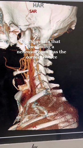 The Anime Addiction: Embracing the Best Hobby Ever