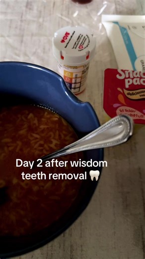 Day 2 After Wisdom Teeth Removal: What to Expect