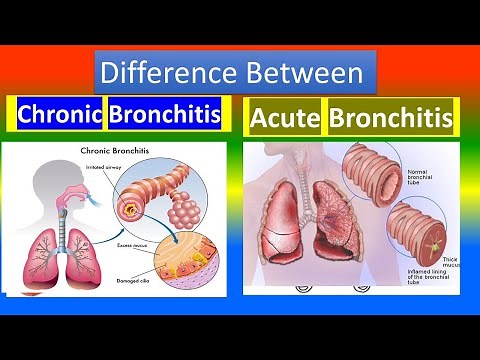 Difference between Chronic Bronchitis and Acute Bronchitis