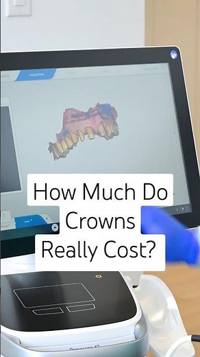 How Much do Crowns Really Cost? Are Dental Crowns Covered by Insurance?