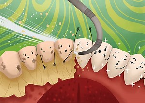 Plaque on Teeth: Tips, Prevention and Causes - Dentistry Book