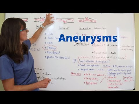 Aneurysms