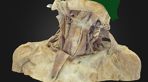 Anterior Cervical Triangle Dissection - 3D model by UBC Medicine - Educational Media