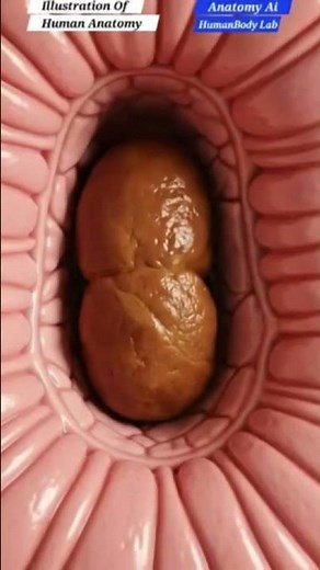 3D Animation of Constipation Explained | Gut Health