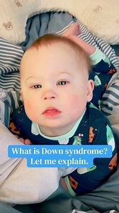 Down syndrome happens when a baby is born with an extra copy of chromosome 21. There are three types — Trisomy 21 (the most common, which Levi has), Translocation, and Mosaic Down syndrome. Every child with Down syndrome is unique, full of strengths, and teaches so much joy. Levi reminds me every day how beautiful life can be. #DownSyndromeAwareness #Parenting #LeviMoments #trisomy21 #downsyndrome #downsyndromelove #theluckyfew #downsyndromerocks | Paige Victoria Crowder