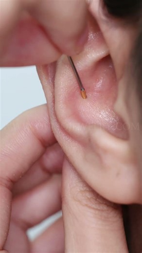 Tulip on my conch piercing!!