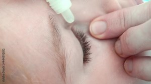 eye drops. in inflamed eyes dripping drops. vision problems.