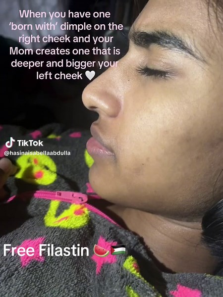 Create Deeper and Bigger Dimples on Your Cheeks | Mom-Daughter Dimple Transformation