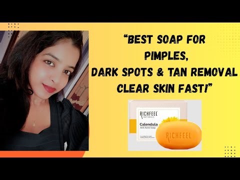 “Best Soap for Pimples, Dark Spots & Tan Removal | Clear Skin Fast!”
