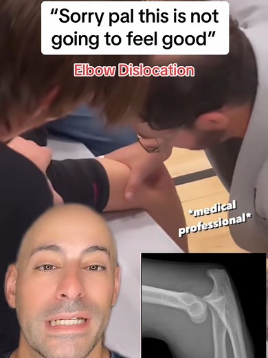 How to Safely Relocate an Elbow Injury