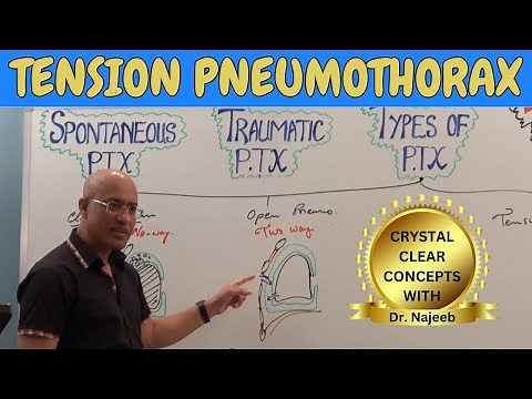 Tension pneumothorax | Causes, Clinical Correlations | Emergency Treatment🩺