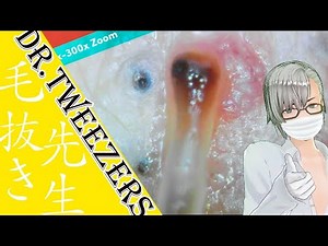 401 [200x Zoom] Consumption tax has risen in Japan Dr. tweezers 毛抜き先生の角栓や毛根
