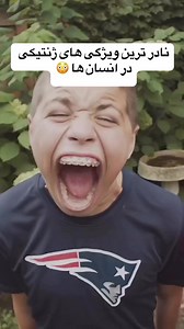 209K views · 2.3K reactions | نادر ترین ویژگی های جنتیکی در انسان ها ! # Genetics#rare# behaviour #lefthande#psychopath# heterochomia | Mr Genius | Facebook