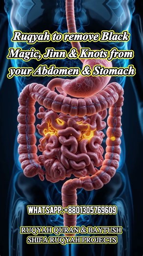 Ruqyah to remove Black Magic, Jinn & Knots from your Abdomen & Stomach