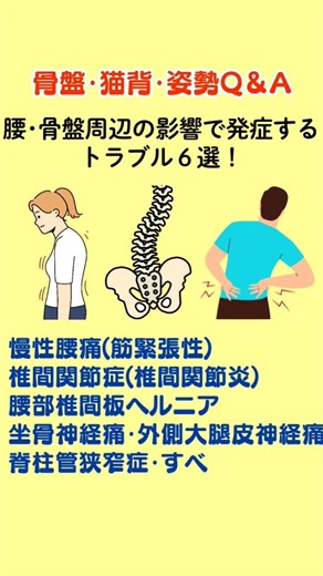 1.慢性腰痛(筋緊張性)2.椎間関節症(椎間関節炎)3.腰部椎間板ヘルニア4.坐骨神経痛･外側大腿皮神経痛5.脊柱管狭窄症･すべり症6.梨状筋症候群#腰痛 #坐骨神経痛 #骨盤矯正 #ヘルニア #整体