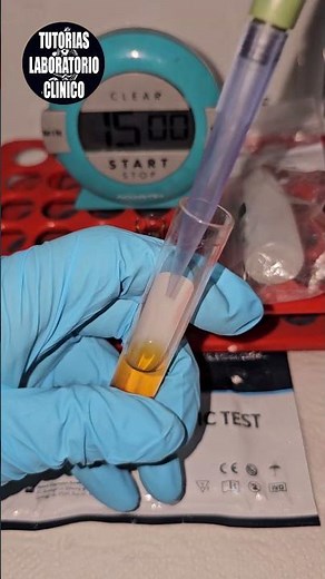 🦟Te Enseño Como Hacer la Prueba RAPIDA para Diagnostico de Antígeno del Dengue NS1- Tutorial ❤️ P1