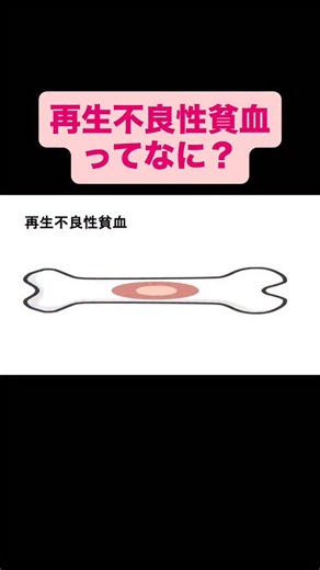 たばえもんナース塾(You Tuber) on Instagram: "再生不良性貧血についての解説です！ #国試 #看護学生 #合格 #看護師国家試験"