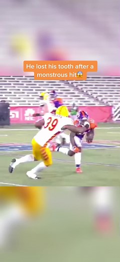 „Yeah, I‘m fine. It was just a wisdom tooth though“😂😂 The actions in this video are performed by professionals. #football #nfl #college #hit #hard #funny #yourfootballhighlights