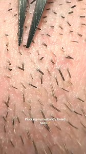 This may be the most satisfying beard hair pluck yet 🤩 #tweezers #slimey #satisfyingvideo #tweeze #pluck #beard #fyp #slime | Jennifer M. Jane