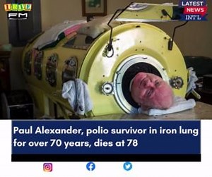 24K views · 80 reactions | Paul Alexander, the man who lived inside...