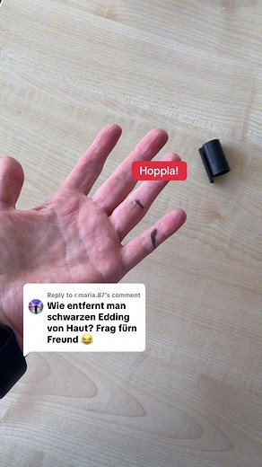 Edding Entfernen: Tips mit Hautdesinfektionsmittel